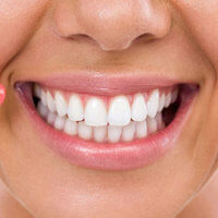 Toothy Smile Repair Discount - Tuesday June 6th